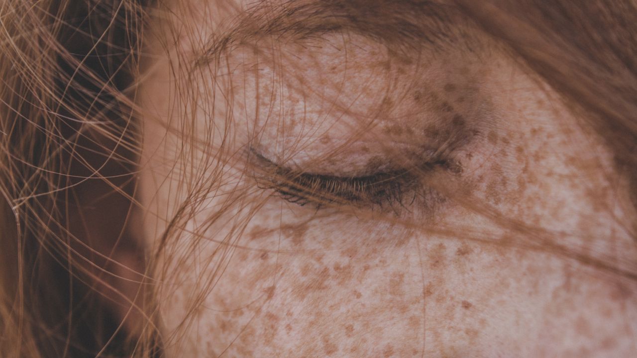 Remoção de Pintas em Campinas: Segurança, Expertise e Preço Justo na Augusta Perfection - Augusta Perfection