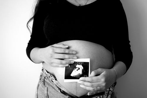 Free A pregnant woman holds an ultrasound photo against her belly, symbolizing expecting motherhood. Stock Photo