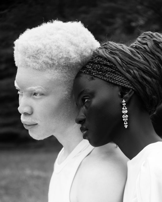 Artistic black and white portrait of albino and dark-skinned individuals showcasing contrast.