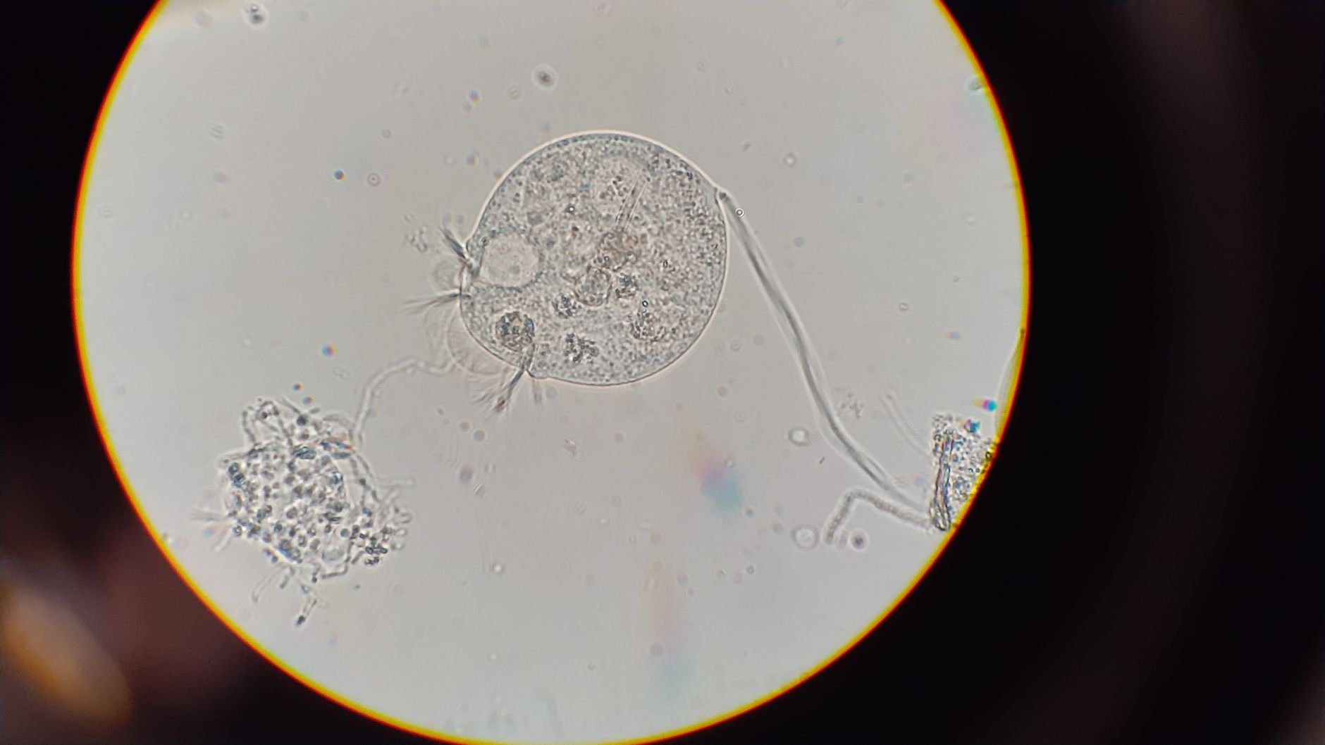 Detailed microscopic image of protozoa in Halifax, showcasing intricate cellular structures.