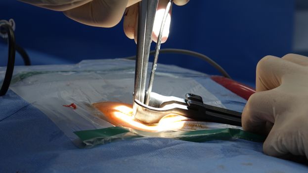 A medical professional discussing spinal implant technology with a patient in a clinical setting.