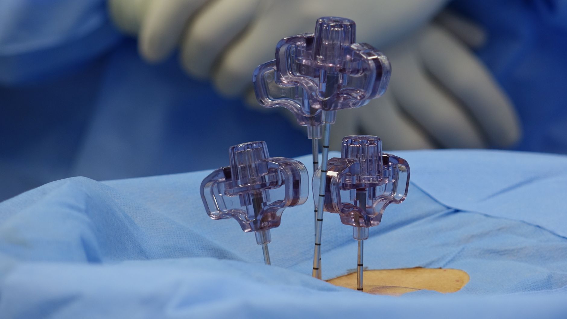Close view of surgical tools during a spinal procedure in an OR.