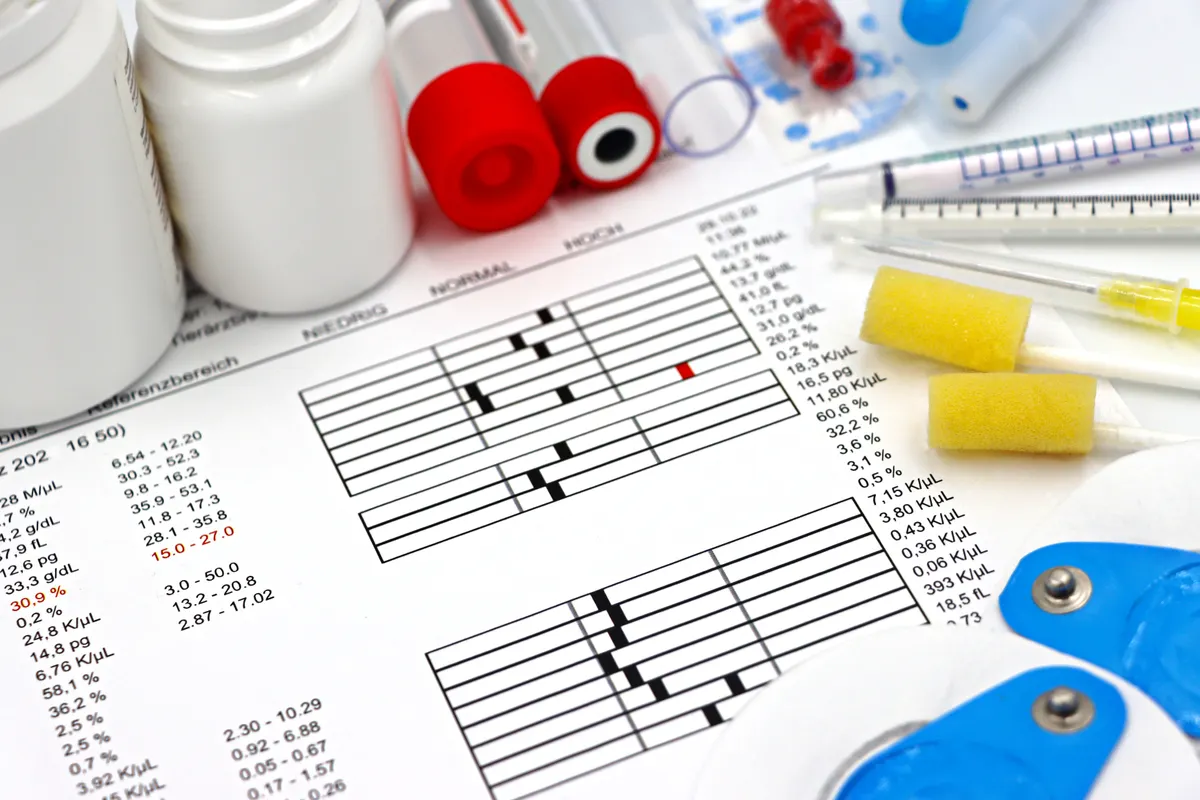 Medical lab report with test tubes, ensuring AI SEO article writer content reliability.