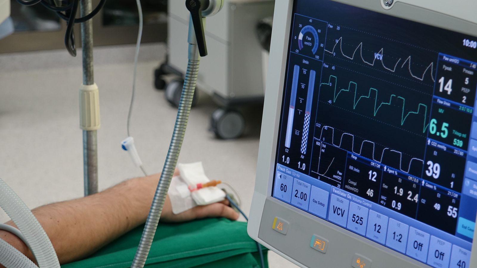 ICU patient monitoring equipment displaying vital signs in a hospital setting