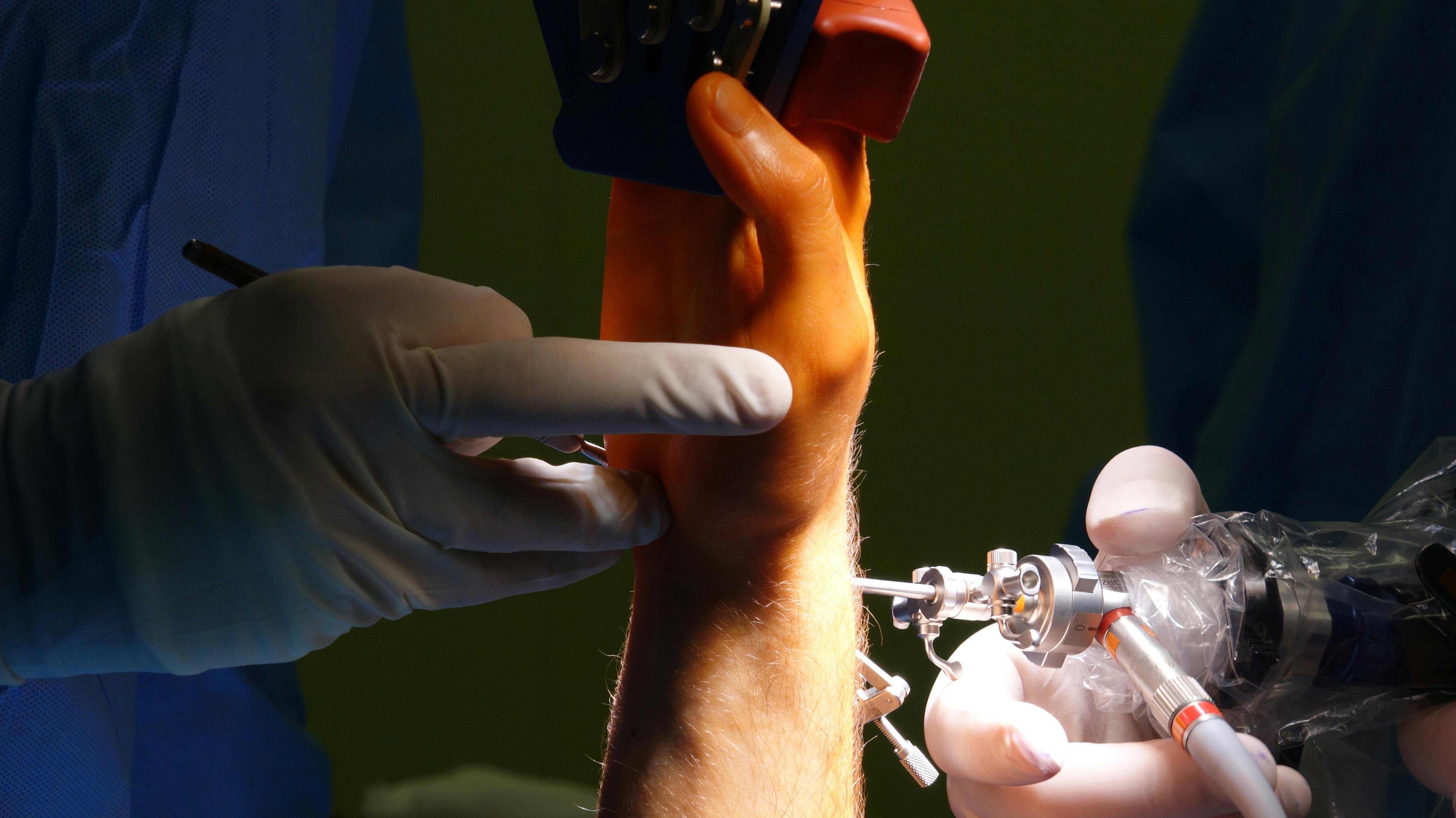 Ücretsiz Tıbbi aletler ve eldivenli ellerle yapılan bilek ameliyatı prosedürünün detaylı görünümü. Stok Fotoğraflar