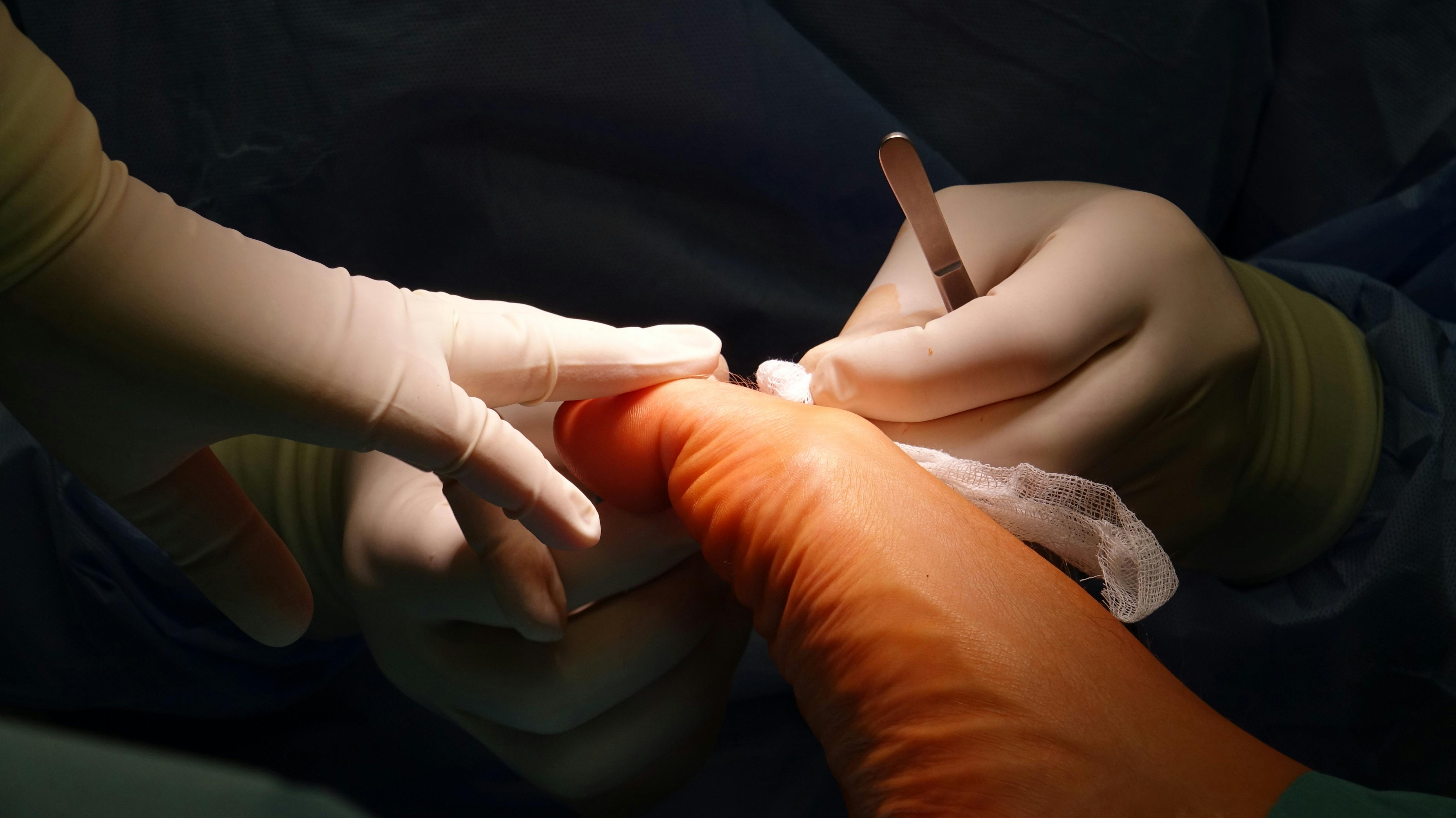 Ücretsiz Tıbbi uzmanlığın sergilendiği, devam eden bir ayak ameliyatının yakın çekimi. Stok Fotoğraflar