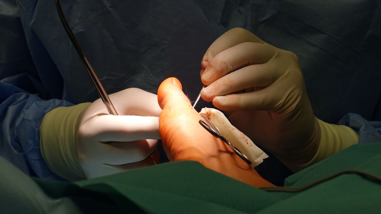 Close-up of Foot Surgery in Operating Room · Free Stock Photo