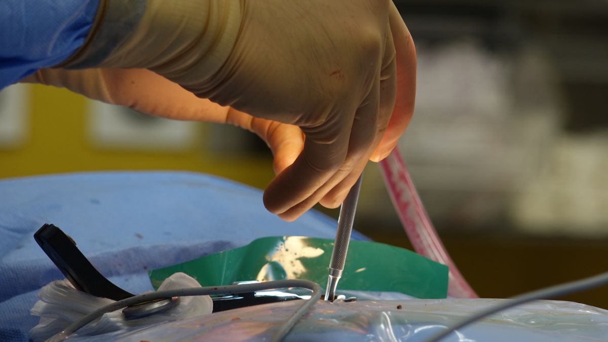 Hysteroscopy Procedure Photos Download The Best Free Hysteroscopy
