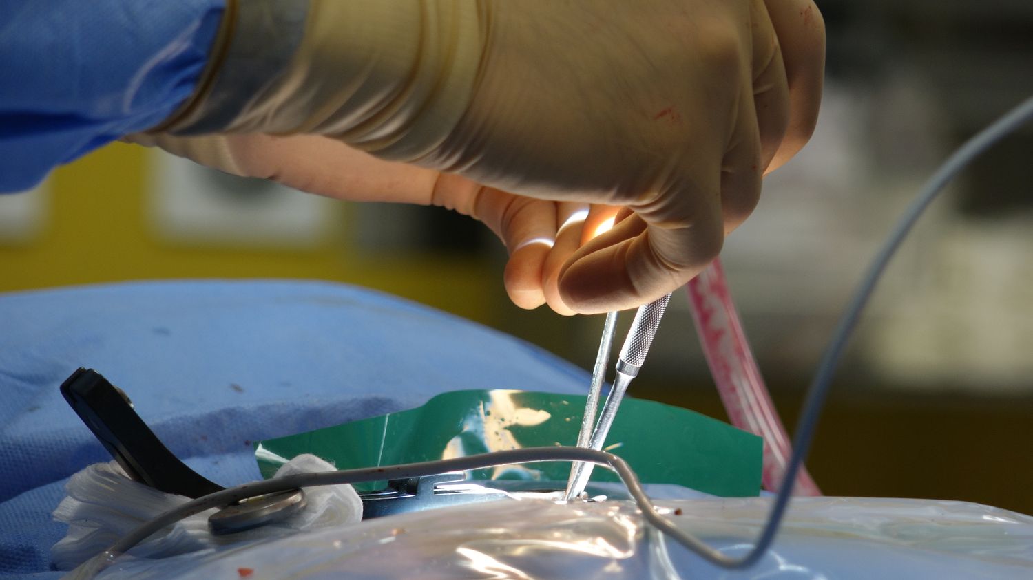 Gros plan sur les mains d'un chirurgien réalisant un geste de précision au bloc