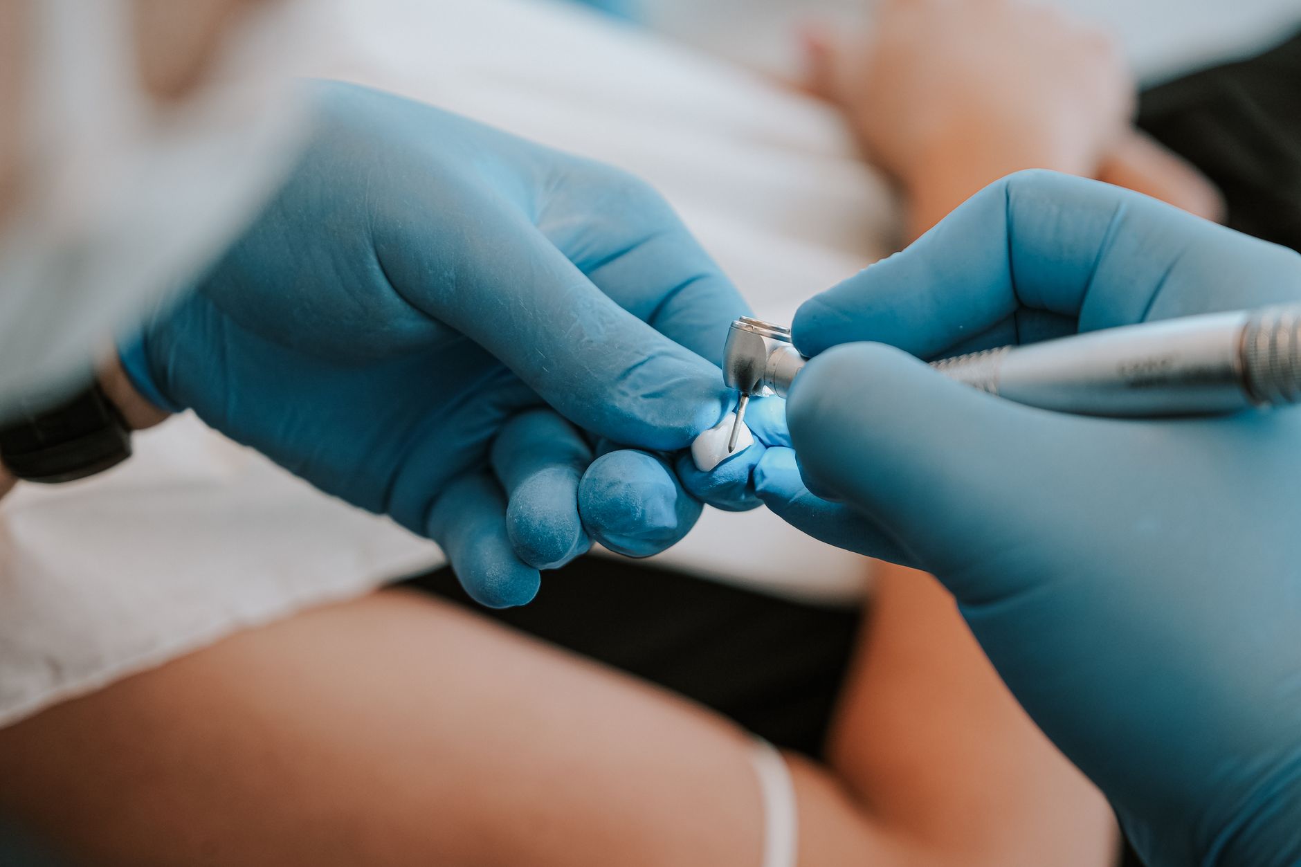 Peeling Elétrico em Bauru: Desvendando a Durabilidade e Cuidados Essenciais - Augusta Perfection