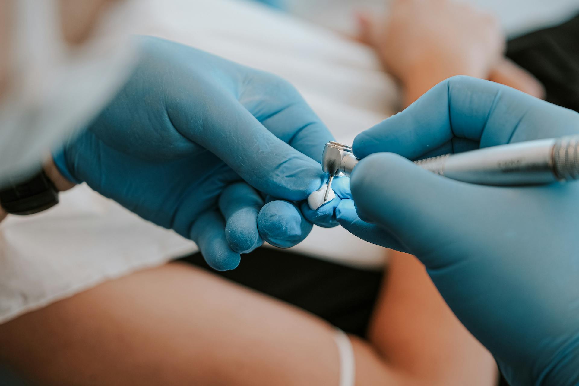 Close-up of a dental procedure with tools in an Antalya clinic, featuring healthcare worker's hands.