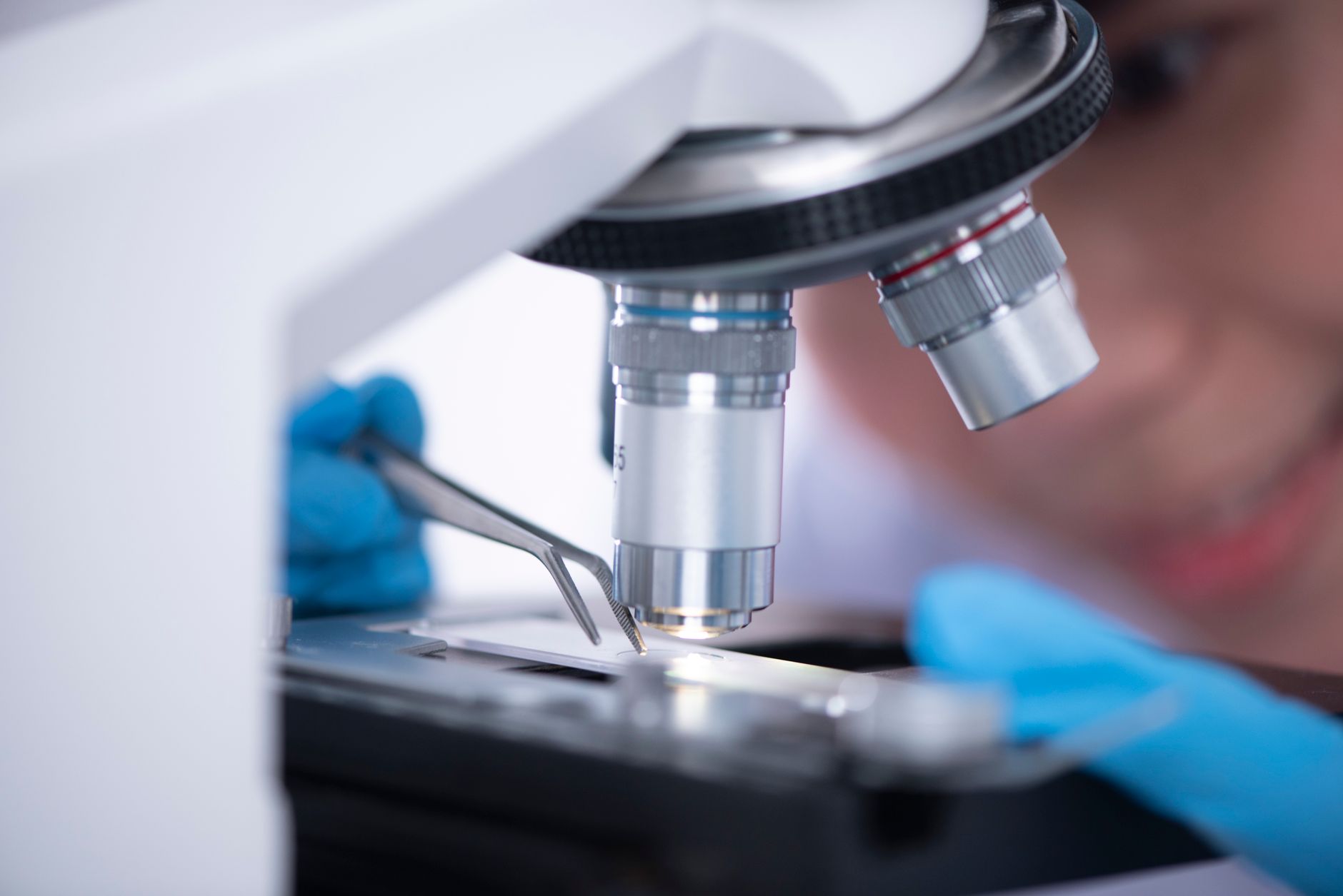 Understanding Follicular Lymphoma Grades: A Guide for Patients
