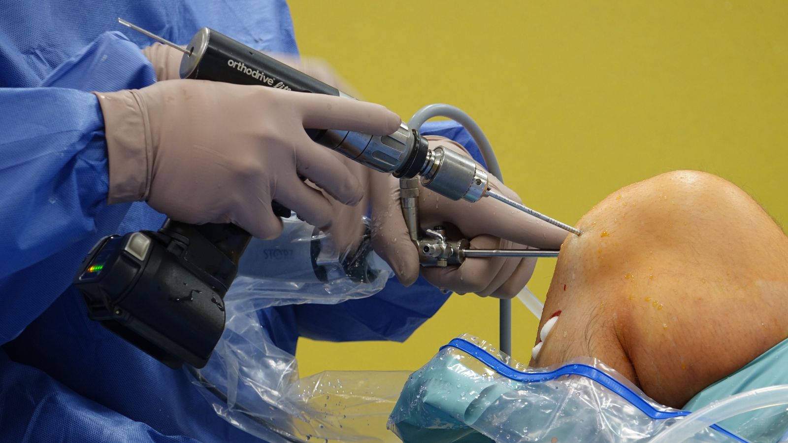 Orthopedic surgeon using equipment in an operating room