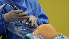 Surgeon Performing Knee Arthroscopy Procedure