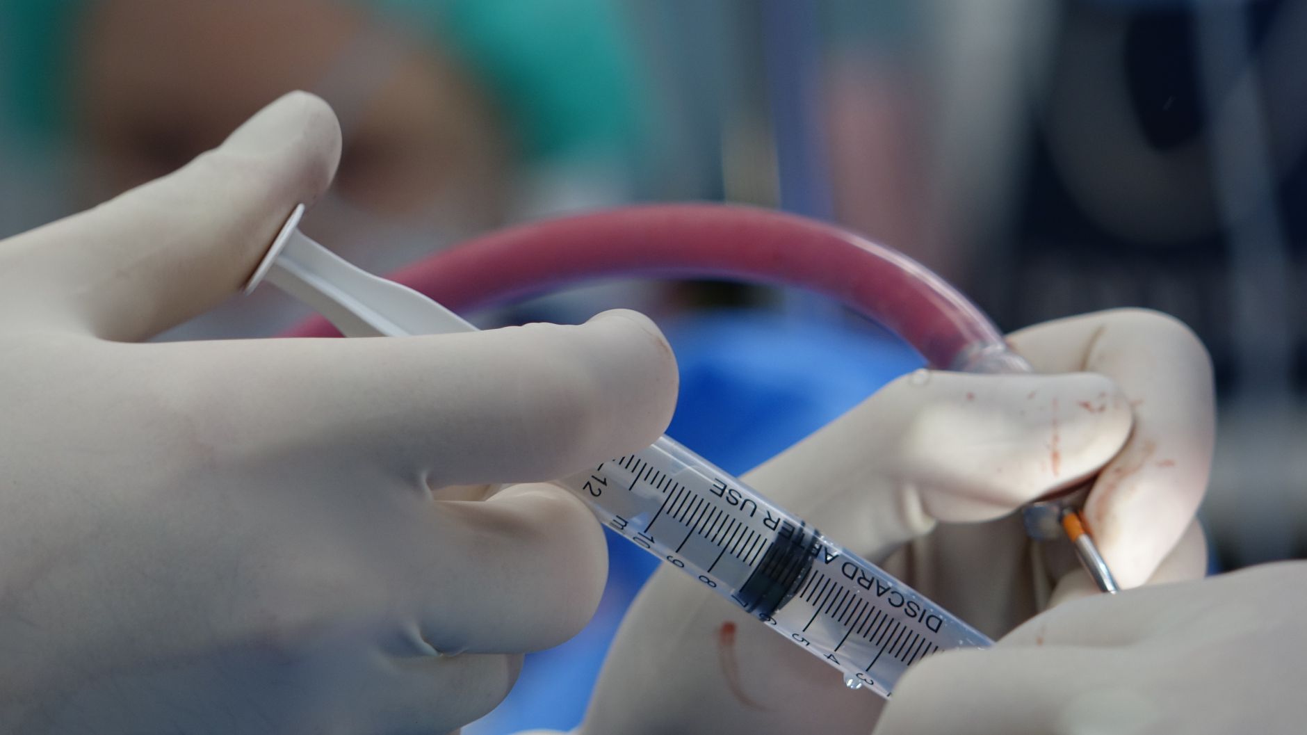 Bladder Botox: Understanding Anesthesia Options for Your Comfort