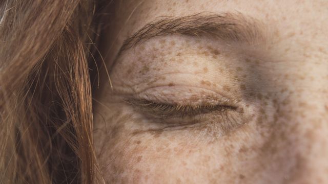 Blefaroplastia sem Cortes em Jaú: Desvendando a Durabilidade e Seus Múltiplos Benefícios - Augusta Perfection