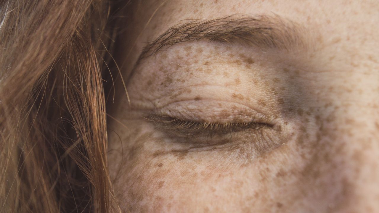 Blefaroplastia sem Cortes em Jaú: Desvendando a Durabilidade e Seus Múltiplos Benefícios - Augusta Perfection