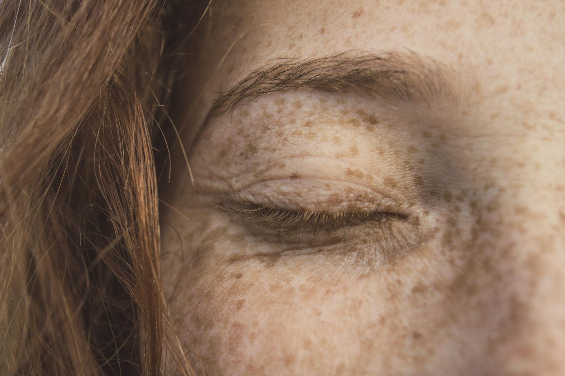 Close-Up Photo of Person's Eyelid