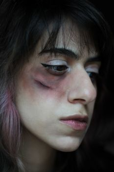 A close-up of a woman's face showing a bruised cheek, conveying emotion and vulnerability.