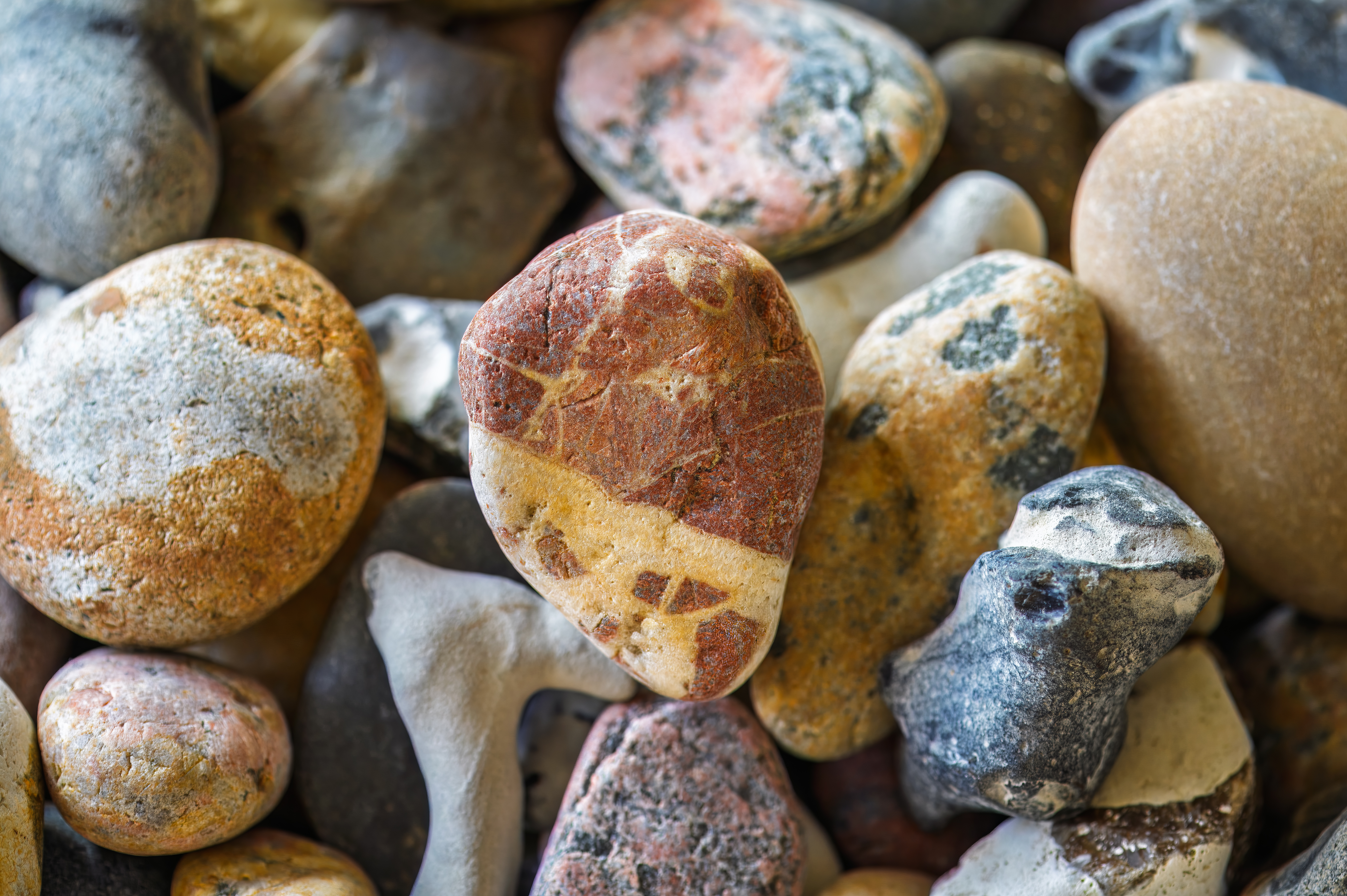 51 Kidney Stones Tips
