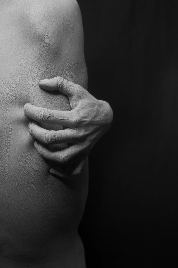 Close-up Photo Of A Person,s Hand Scratching 
 On His Flaky Skin In Black And White
