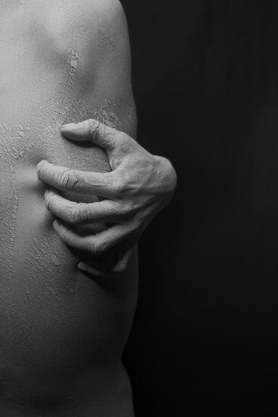 Dry flaky skin associated with eczema