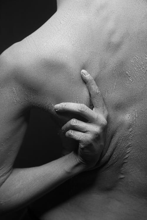 Close-up Of A Person Scratching The Dry And Flaky Skin Of His Back In Black And White