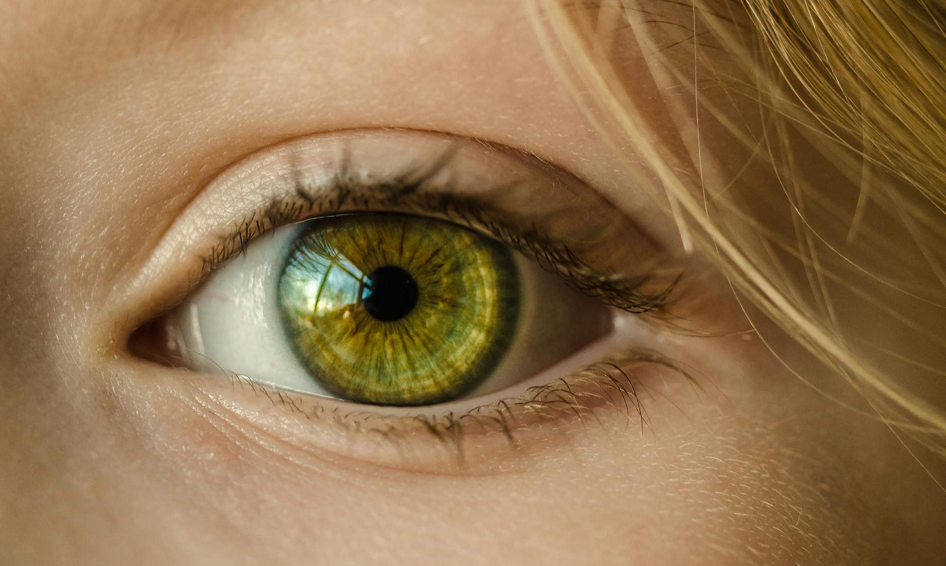 Blepharitis: Understanding Eyelid Inflammation and Home Care