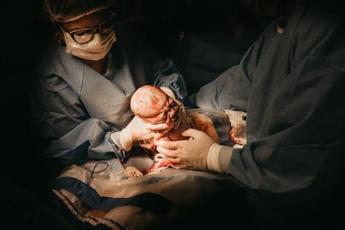 Mujer Dando A Luz A Un Bebé Mediante Cesárea