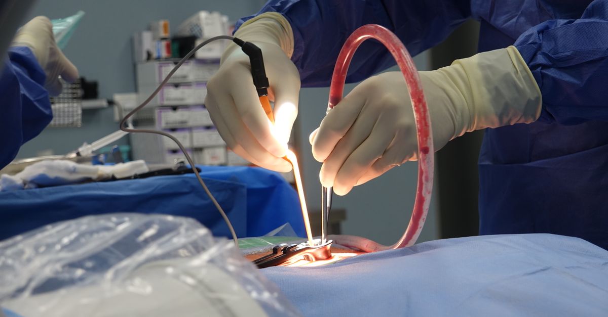 CRT Outperforms Short-Course RT in Rectal Cancer Preservation