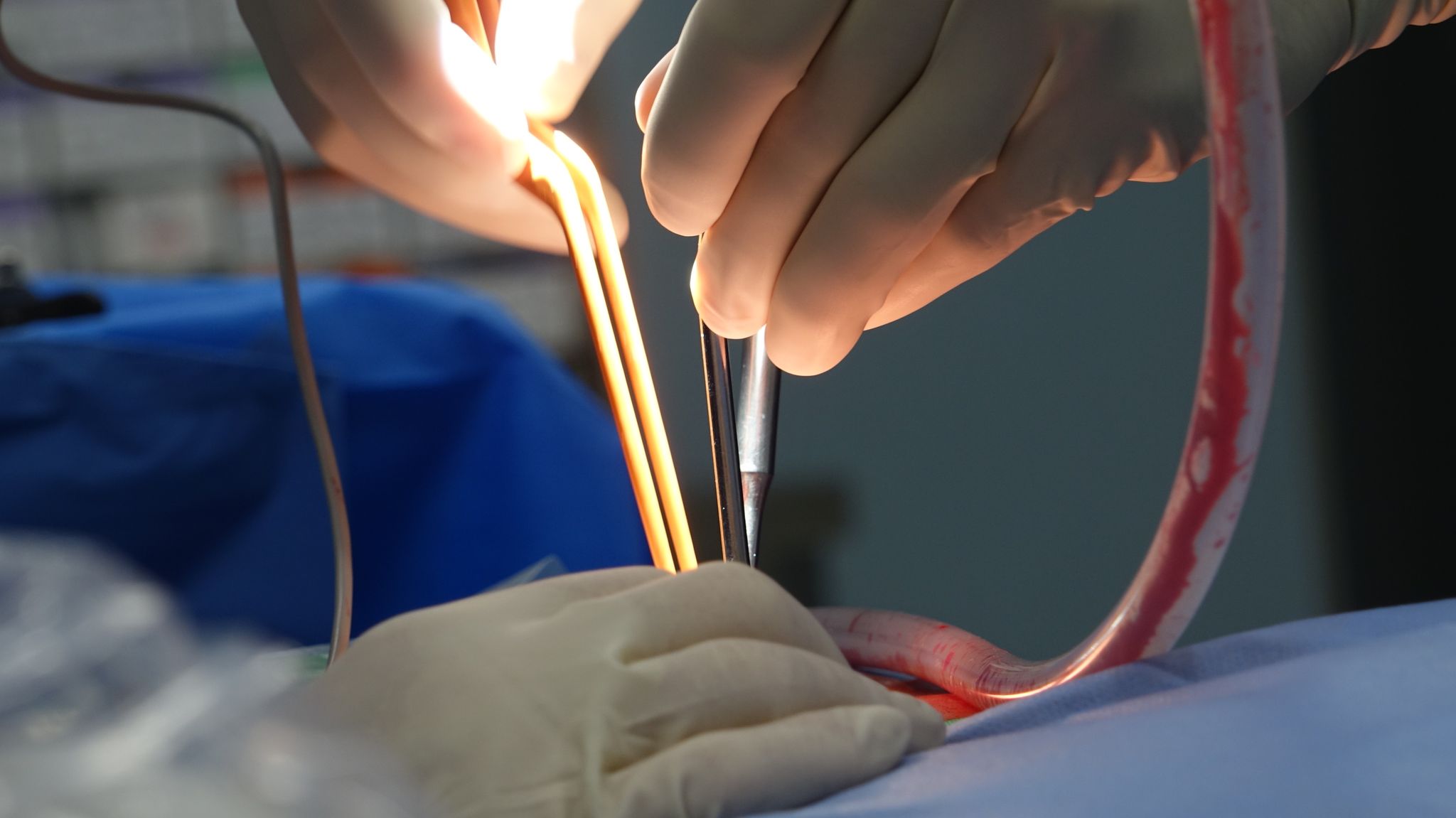 Vrouw krijgt worm in voet na vakantie in Azië