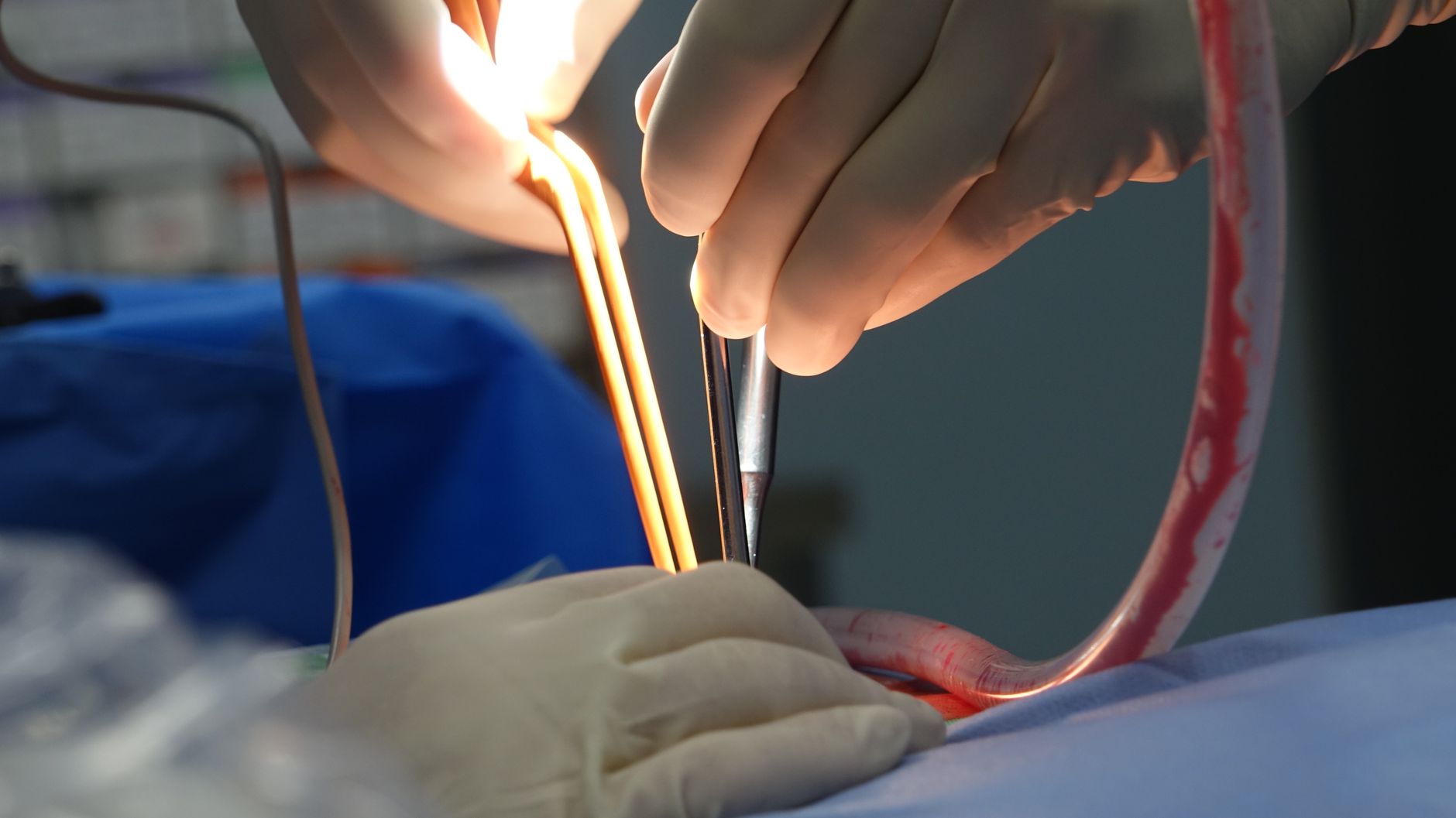 Free stock photo of anesthesia, blood loss, complications
