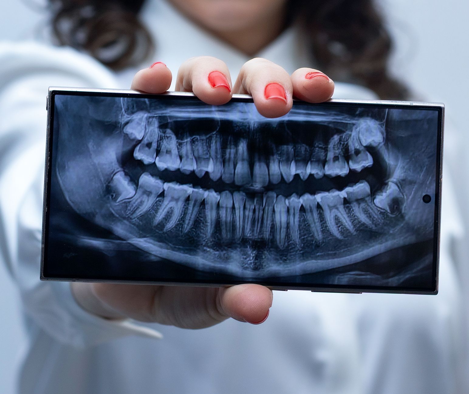 Digital Radiography - Denwest Dental Clinic Digital Radiography in Nashville, ON - Best Way to Get Fast Digital X-rays in Nashville, ON