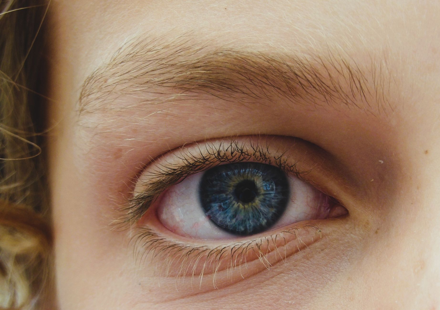 Internal Stye: Understanding the Painful Bump Inside Your Eyelid