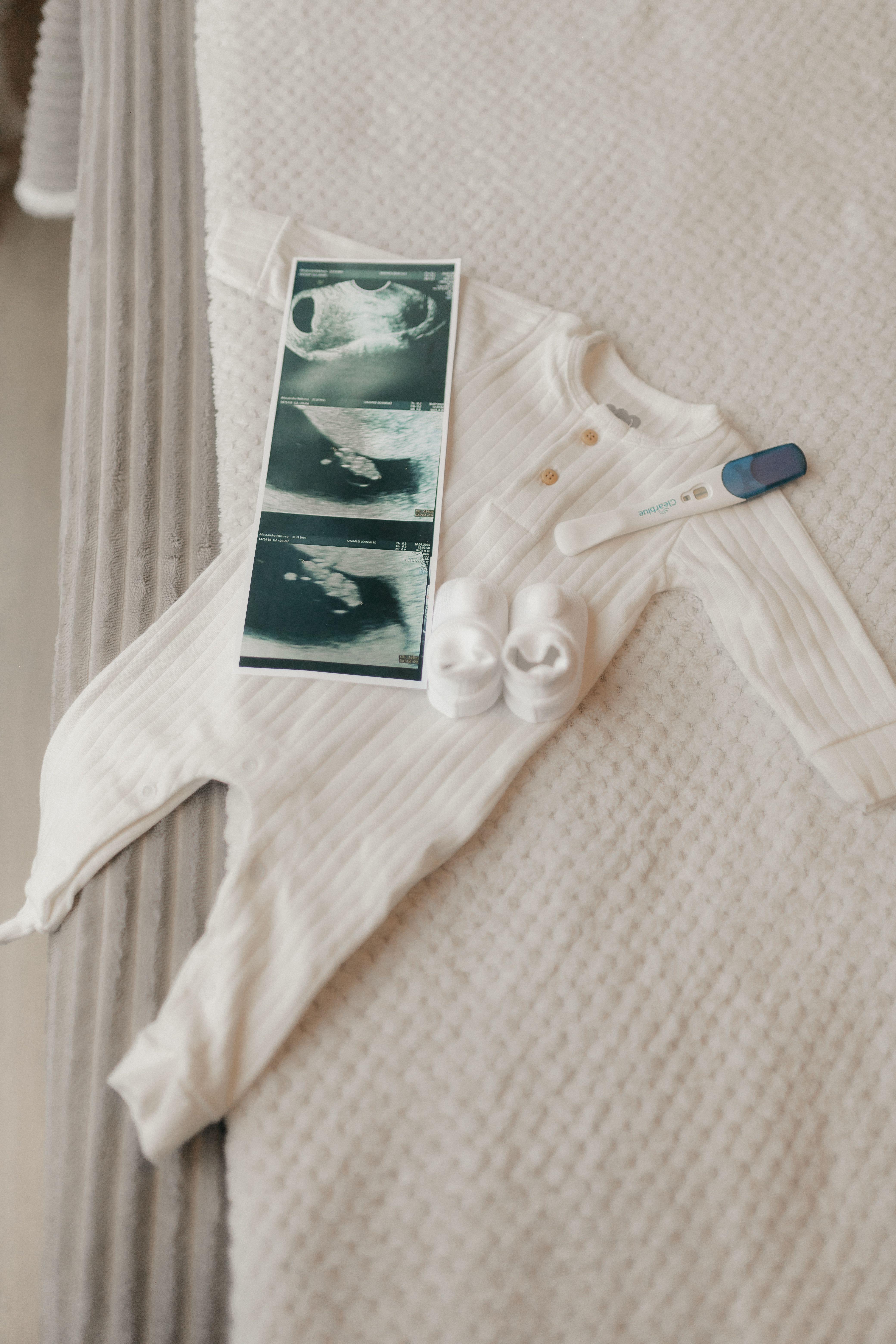 Pregnancy Announcement with Ultrasound and Baby Clothes · Free Stock Photo