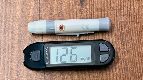 Postprandial lipaemia: why the hours after a meal are their own measurement window