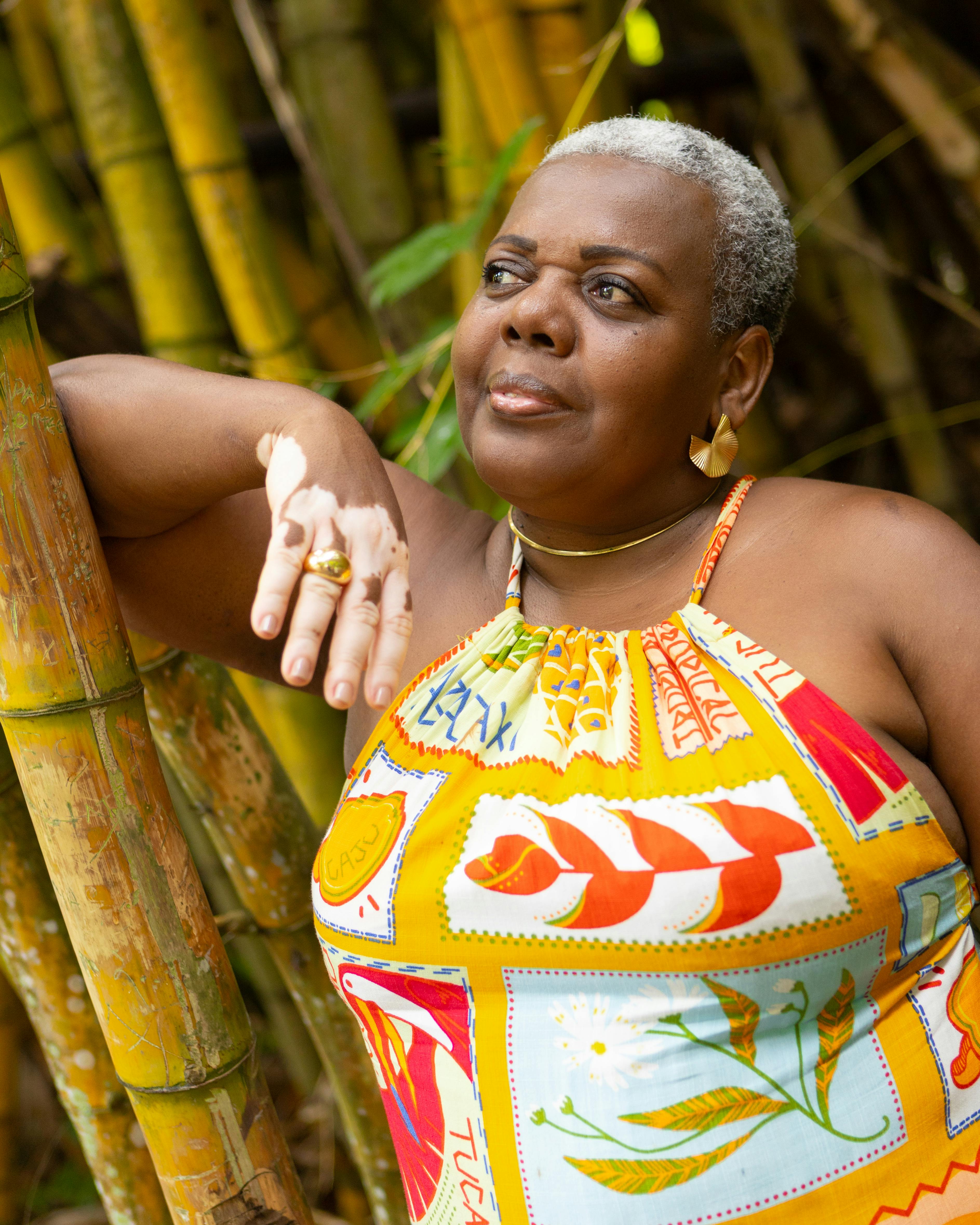 A woman with vitiligo enjoys a serene moment in Bahia's lush bamboo forest.