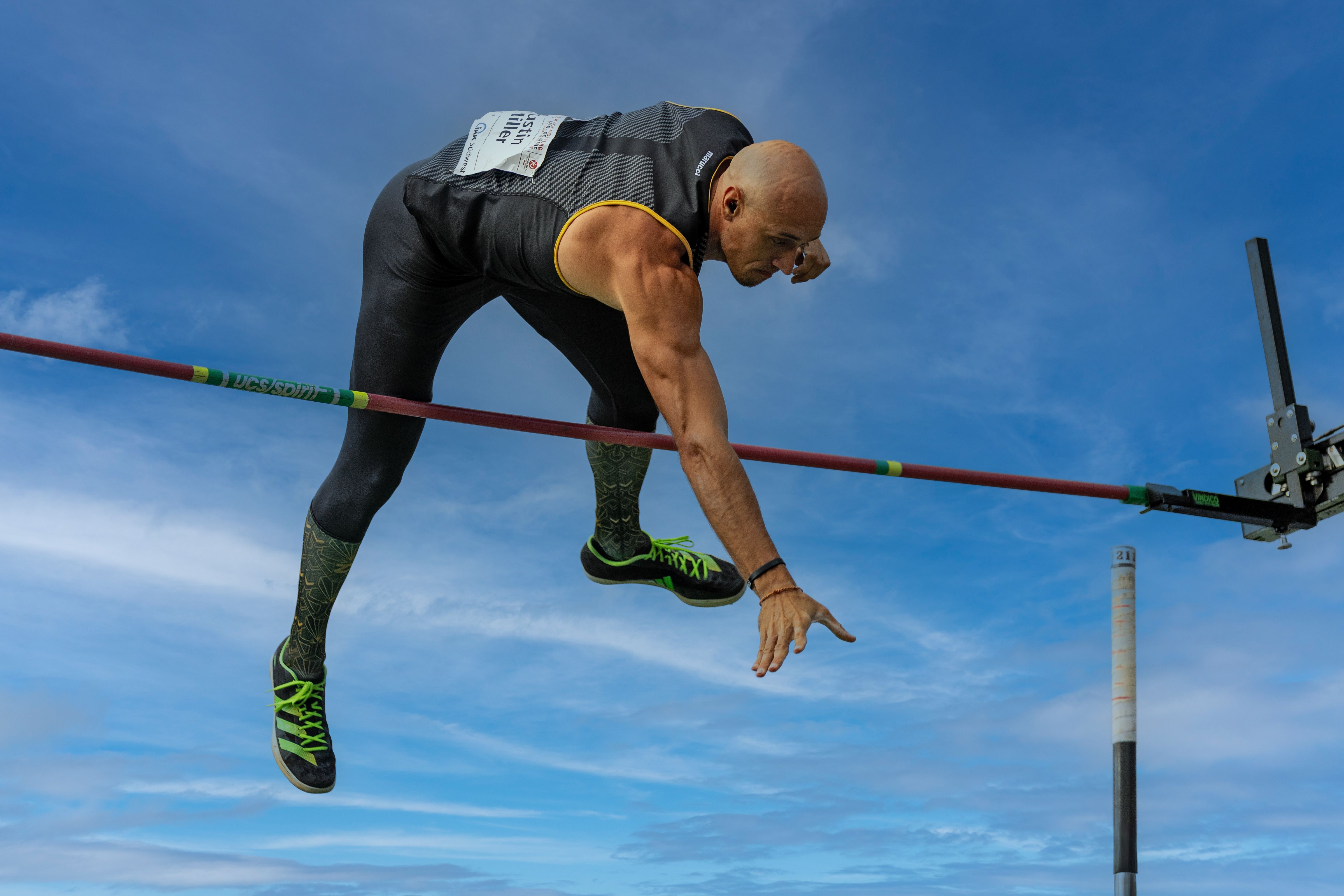 Men's higher TB burden may stem from greater exposure, not disease progression
