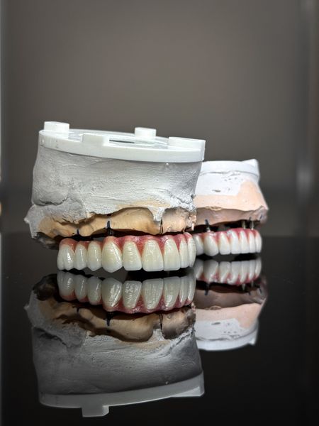 Modelos dentales con piezas artificiales