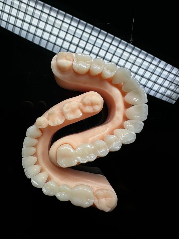 Dental 3D Baskı Diş Kalıbı Modeli