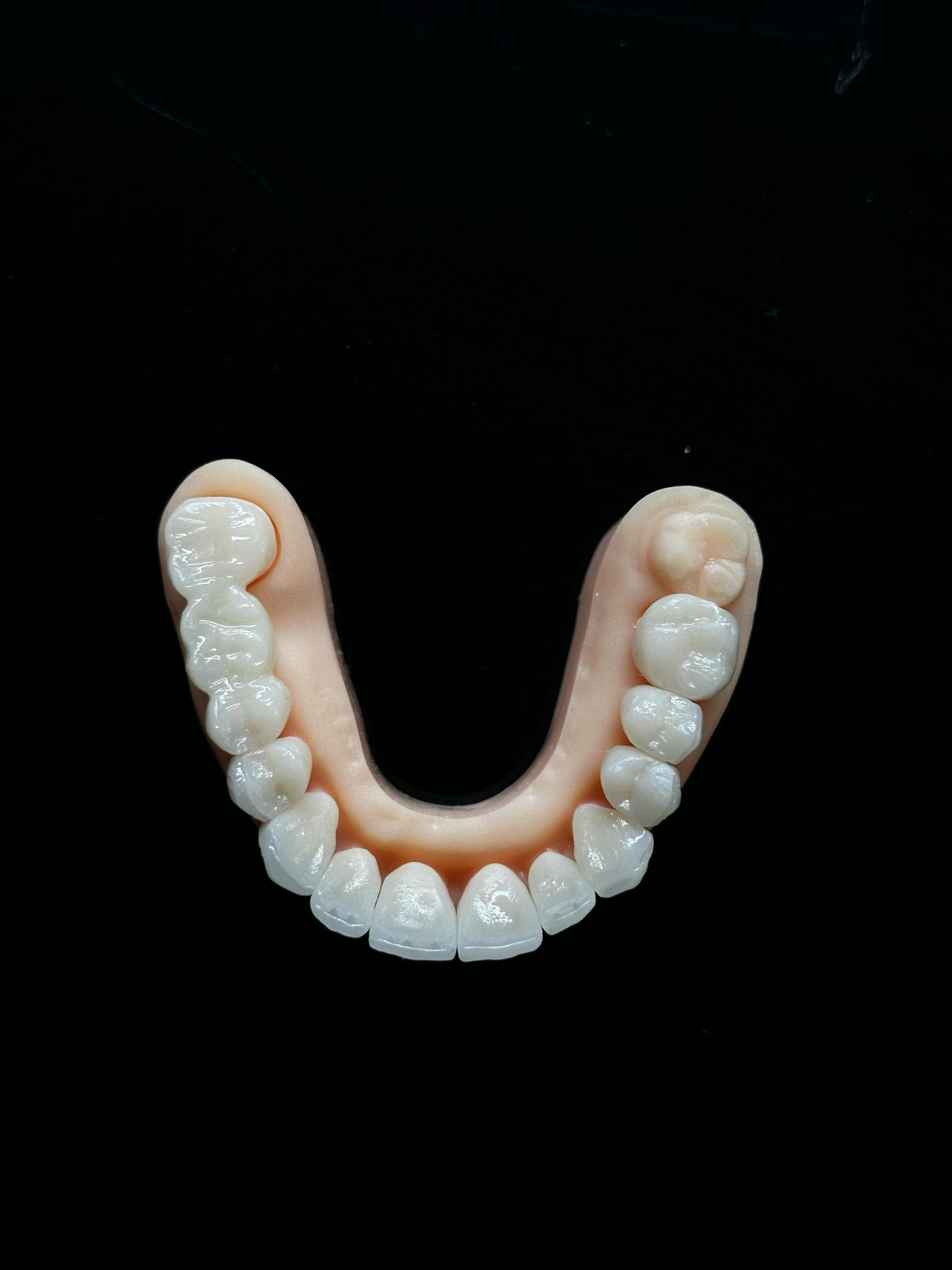 common:alt.prefix Darmowe zdjęcie z galerii z anatomia stomatologiczna, aparat stomatologiczny, bielsze zęby common:alt.postfix