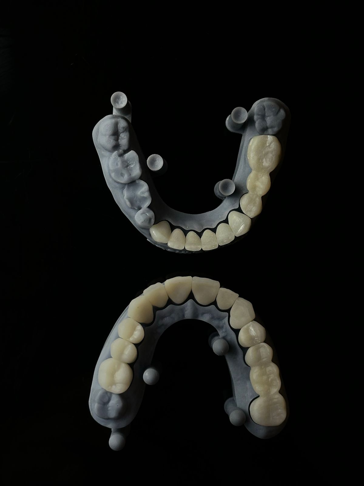 3D printer producing a dental appliance model