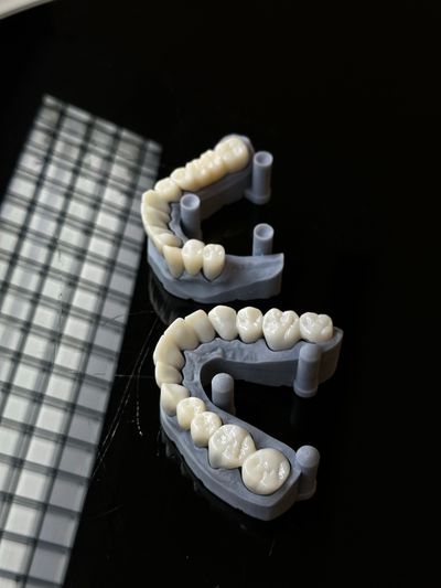 Dental 3D Baskı Laboratuvar Ekipman Diş
