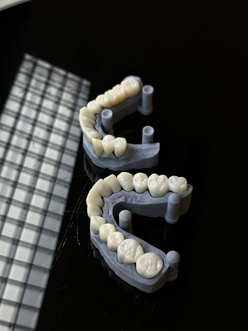 Dental 3D Baskı - Diş Protez Modeli Cerrahi Kılavuz İmplant Konya