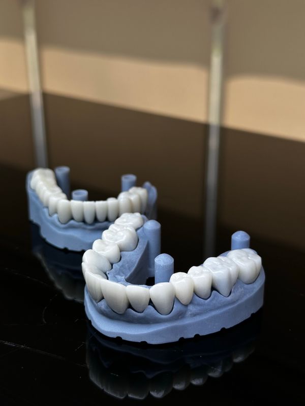 Impresiones dentales realistas de alta precisión
