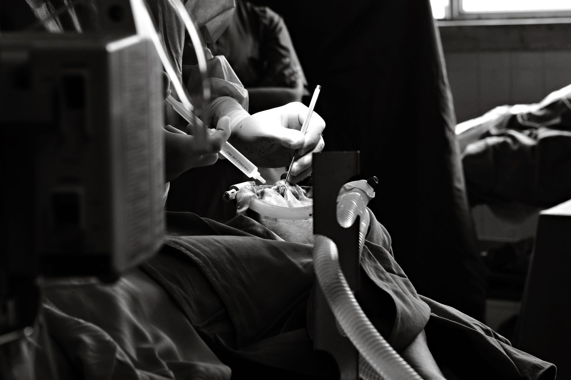 Uterine Fibroid Embolization: A Detailed Look at This Minimally Invasive Treatment