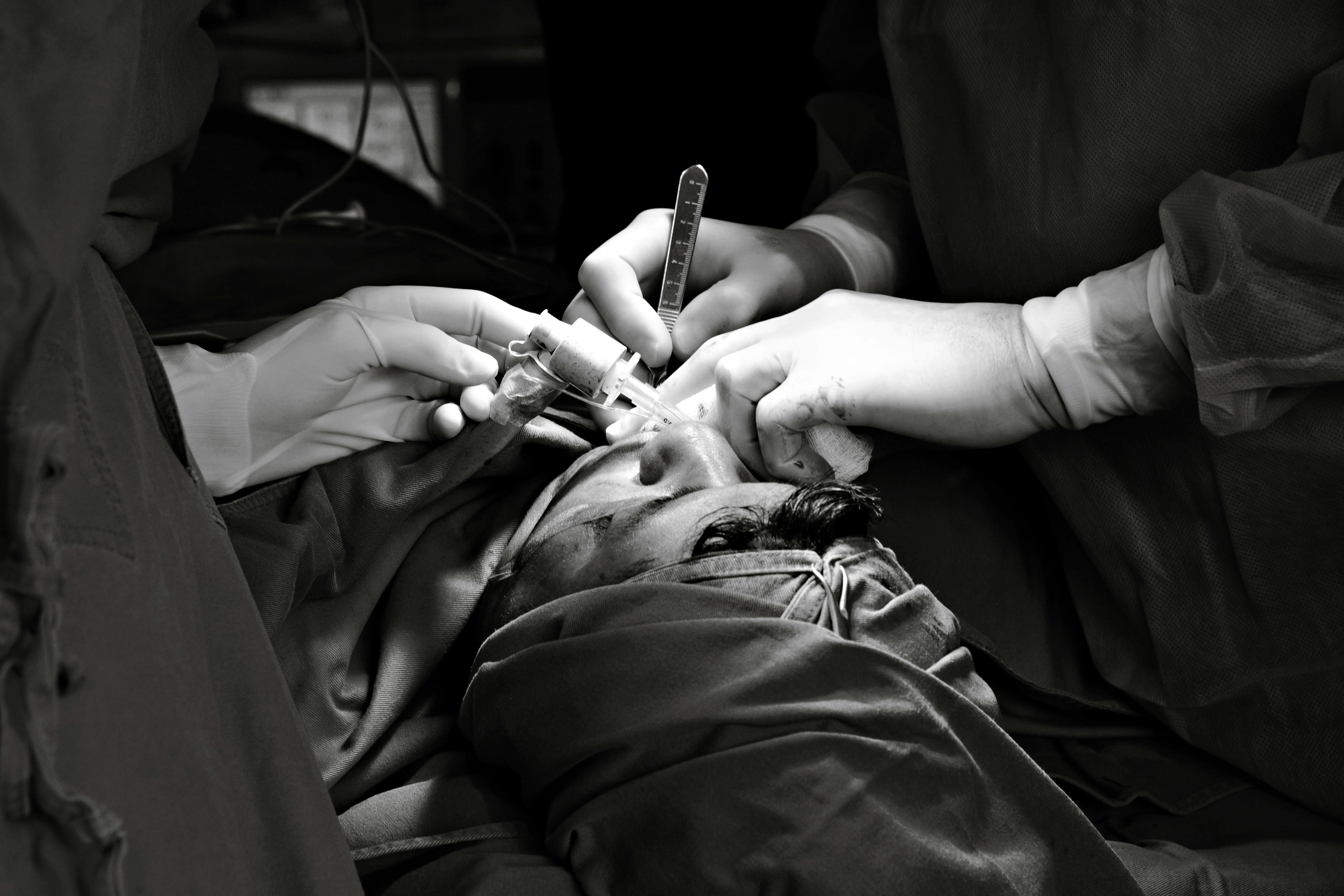 Black and white photograph of surgeons performing a precise operation using medical equipment.