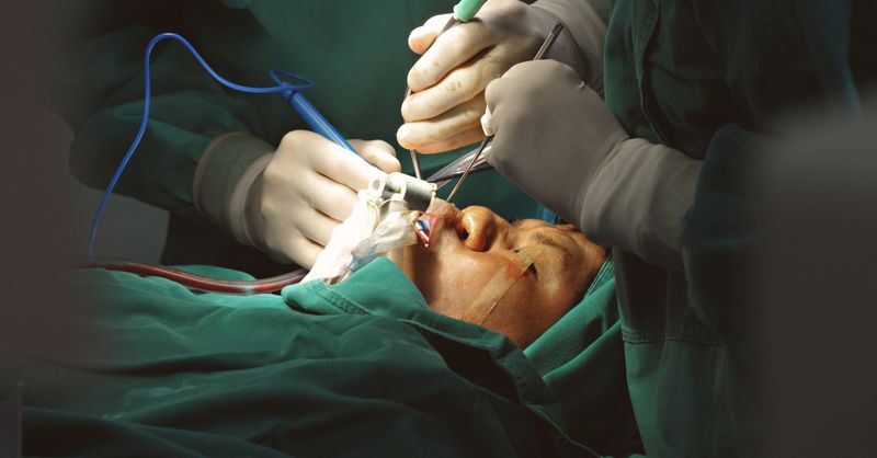 Angoisse Opération Cataracte : 8 Conseils Apaisants