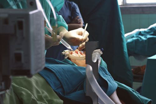 Free A detailed view of surgeons operating in a sterile environment, showcasing medical equipment and precision. Stock Photo
