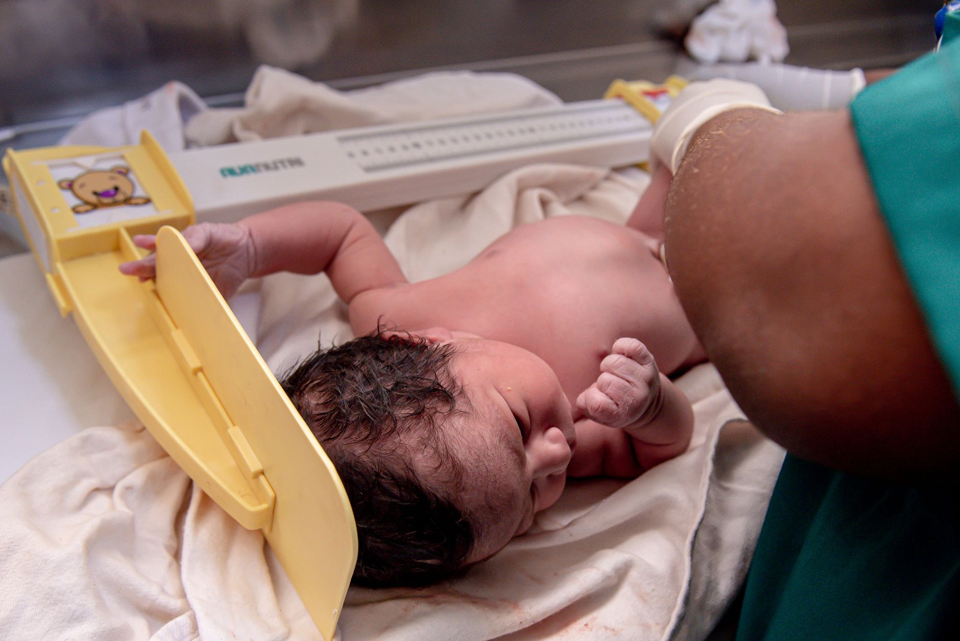 Tratamento de icterícia neonatal em Campinas